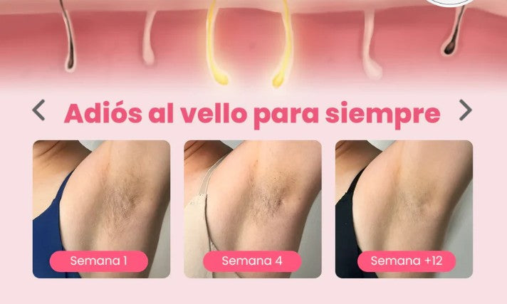 Depiladora Laser Permanente IPL
